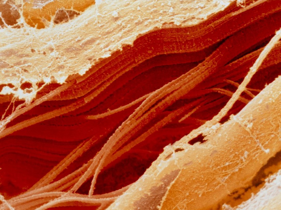 Сырое мясо под микроскопом